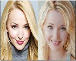 Dove Cameron before surgery